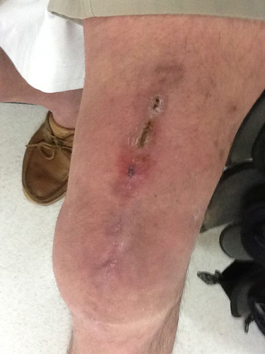 leg